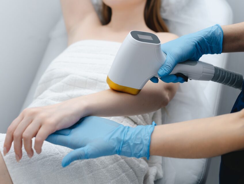 laser hair removal claims